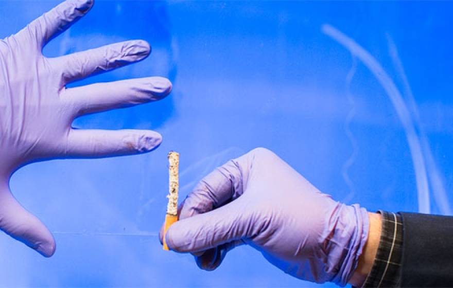 Lung Cancer Lab Testing